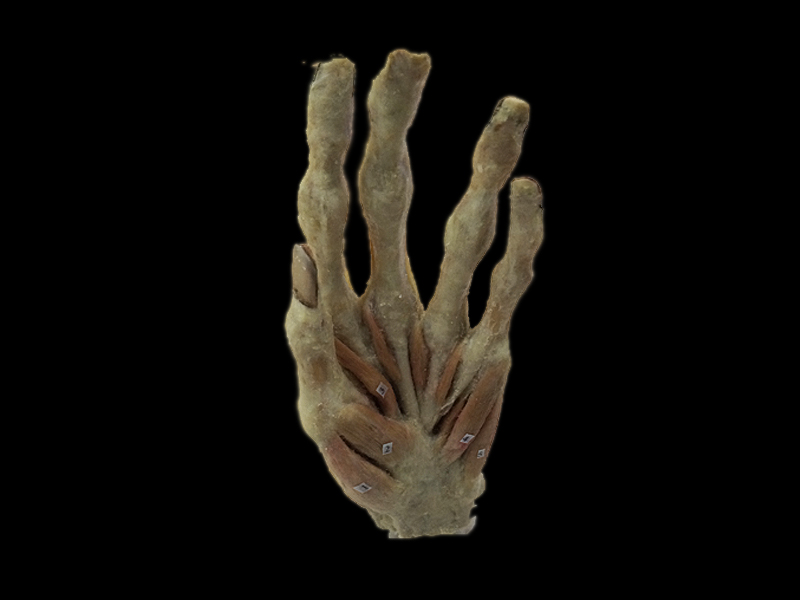 Superficial muscles of hand plastinated specimens (preserved specimen )