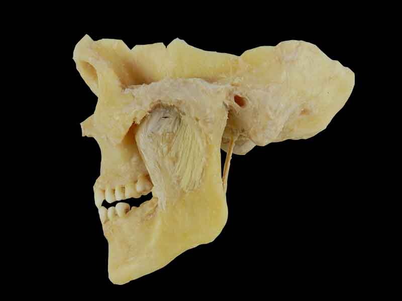 temporal mandibular joint specimen