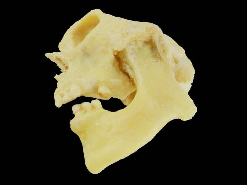 temporomandibular articulation plastinated specimen