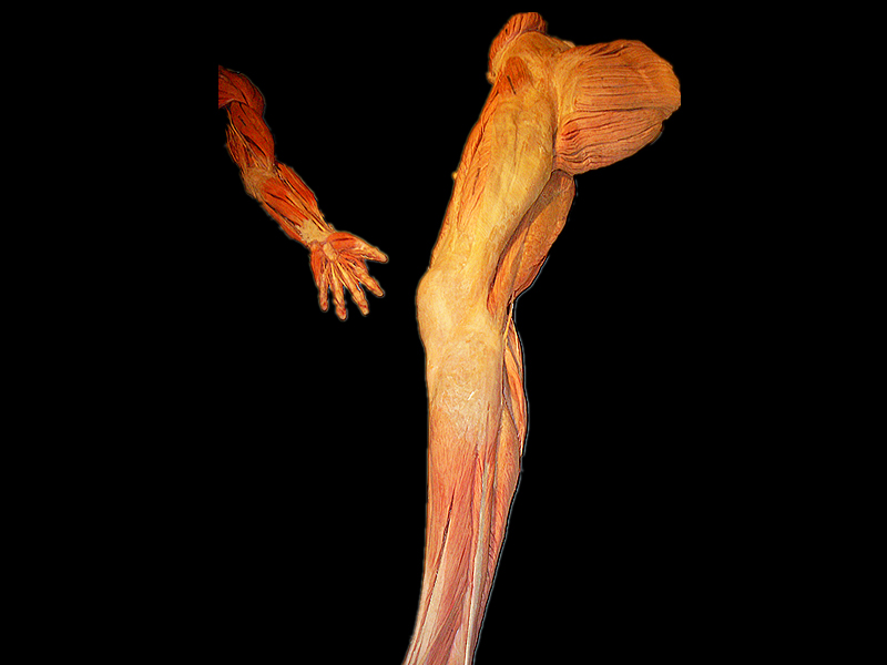 Upper and lower limb muscles plastinated specimens (medical specimen museum )