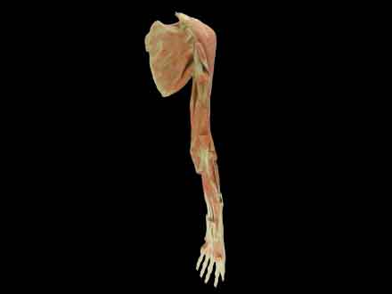 Upper limb (from shoulder)