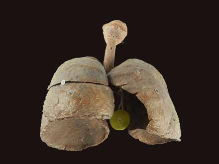 lung and larynx teaching specimen