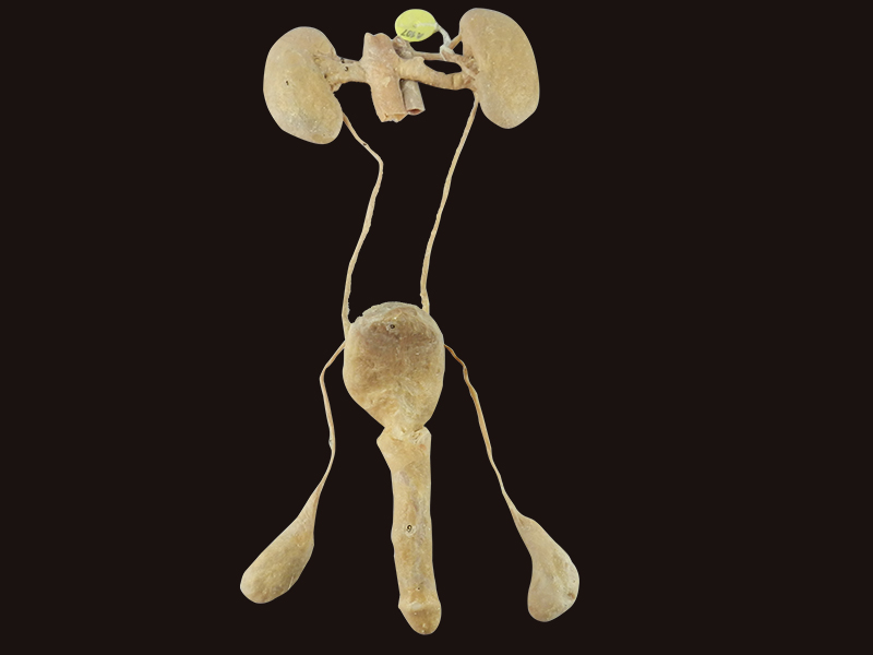 male urogenital system