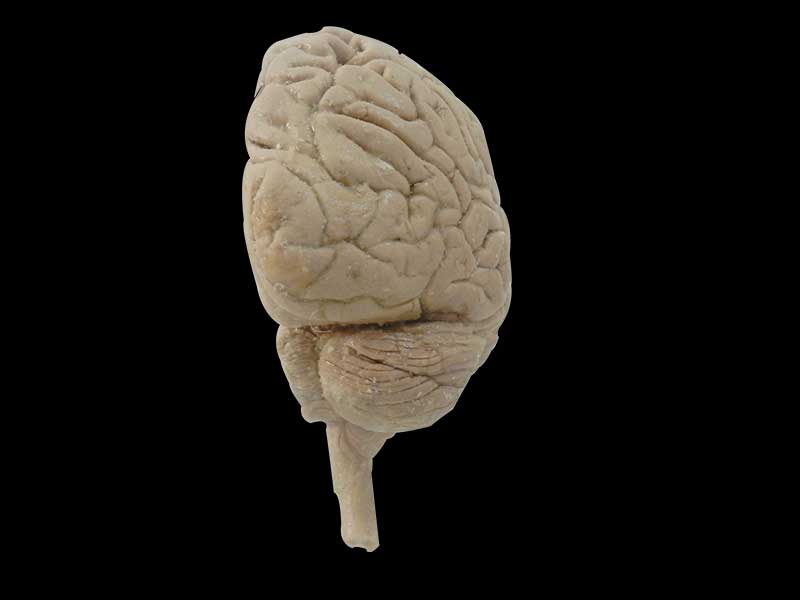 Median sagittal section of brain plastinated specimen