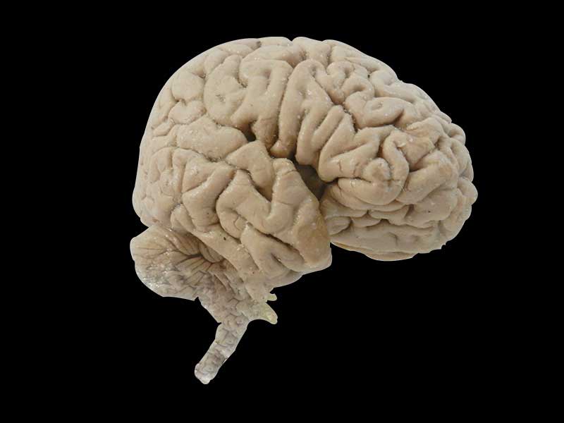 Median sagittal section of brain plastination