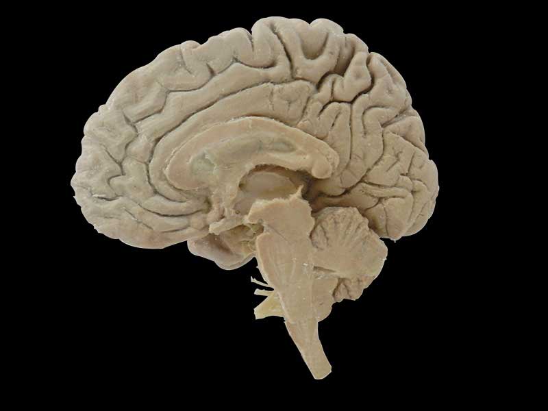 Median sagittal section of brain