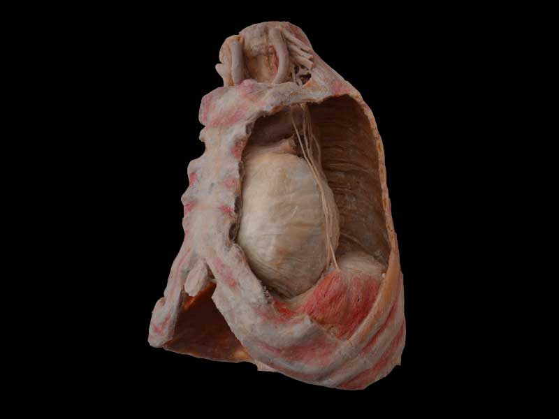 Mediastinal organs and diaphragm plastination specimen