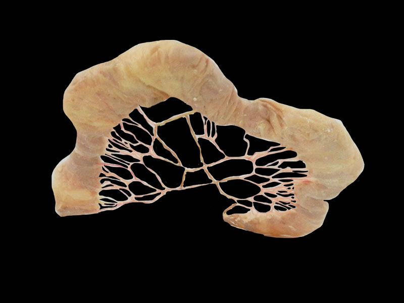 medical human jejunal vascular arch