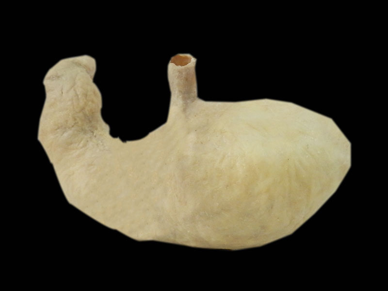 medical stomach specimen