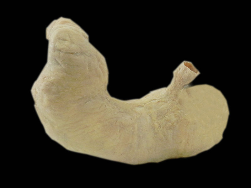 medical stomach teaching specimen