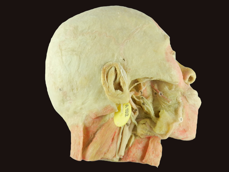 Muscles of neck and carotid plastinated specimen