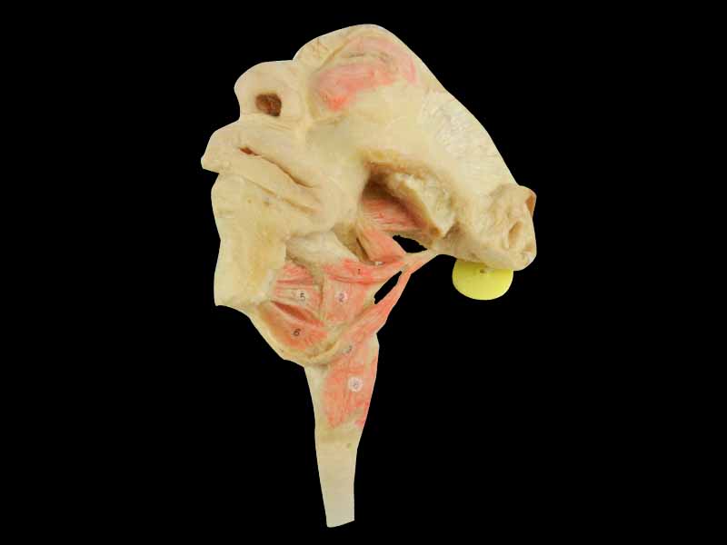 Musles of tongue plastination