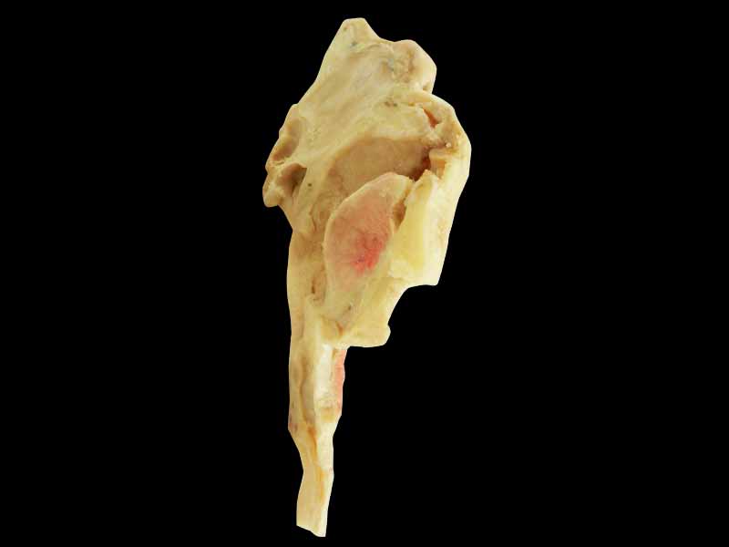 Musles of tongue specimen for sale