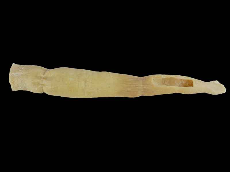 Oesophagus