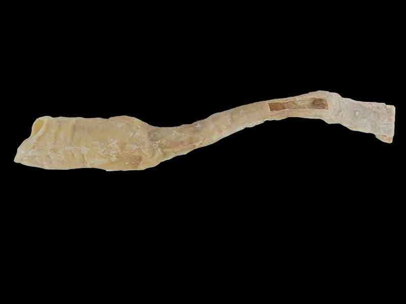 Oesophagus medical specimen