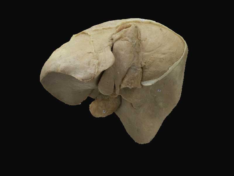 Overview of liver plastinated specimens(plastinated anatomical specimens) 