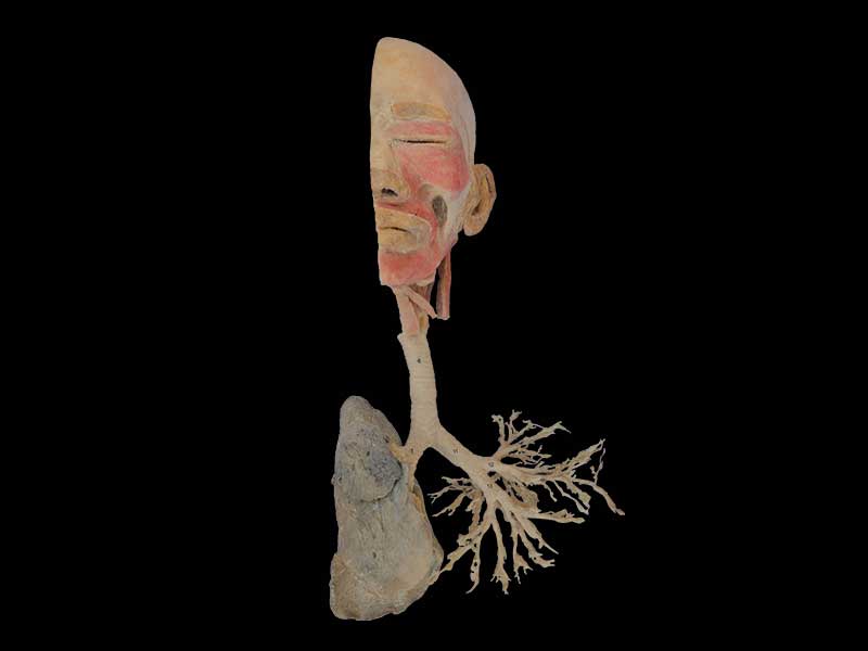 Overview of the respiratory system plastinated specimen