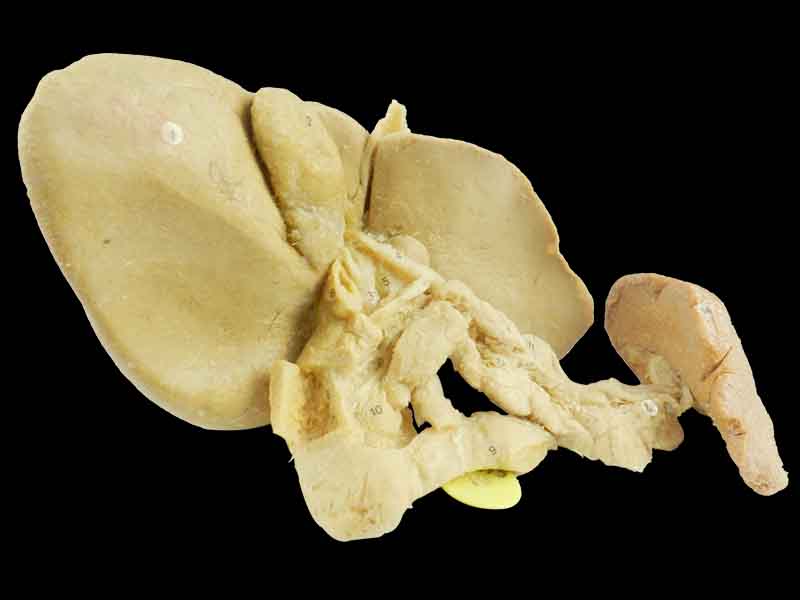Pancreas spleen and duodenum in vitro plastinated specimen
