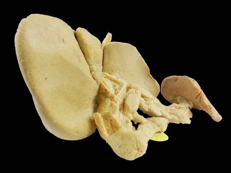 Pancreas spleen and duodenum in vitro plastination