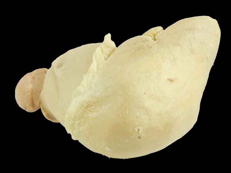 Pancreas spleen and duodenum in vitro specimen