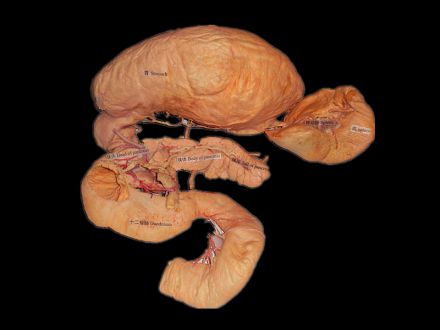 Pancreas spleen and duodenum plastinated specimens(buy plastinated specimens)