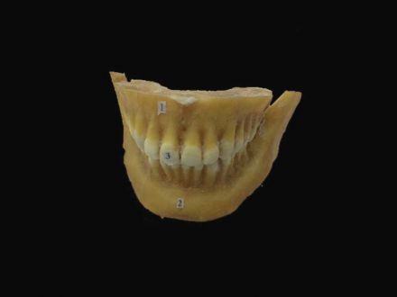 Permanent teeth in situ plastinated specimens (plastinated specimens india) 