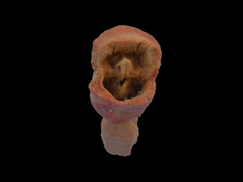 Pharynx and larynx plastinated specimen