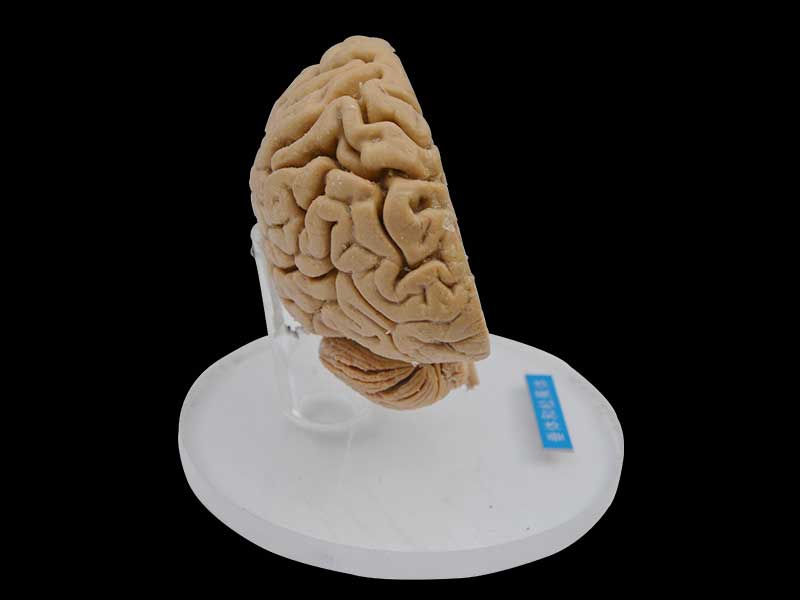 Pituitary and pineal gland plastinated specimen