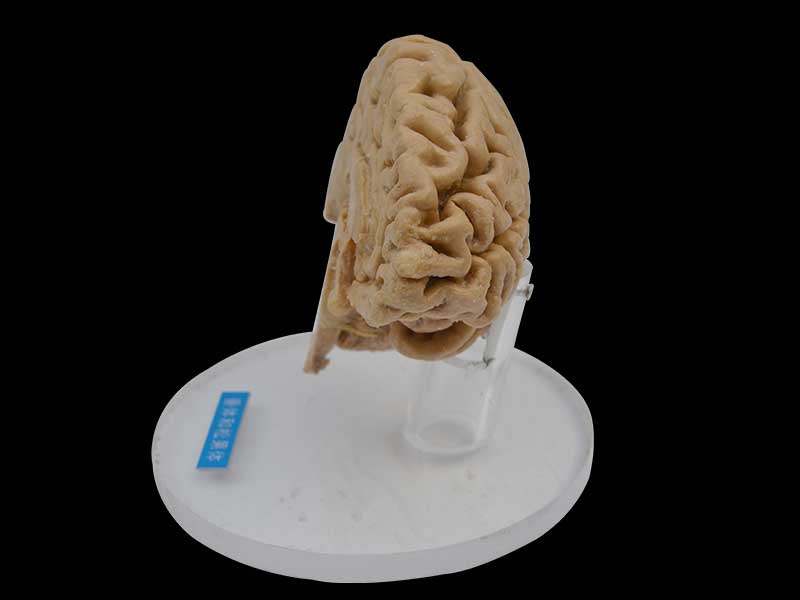 Pituitary and pineal gland plastination