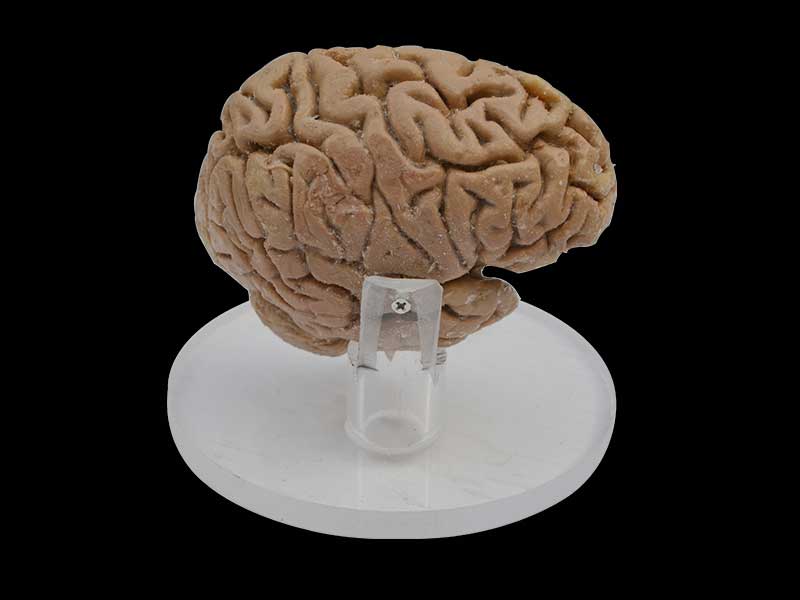 Pituitary and pineal gland