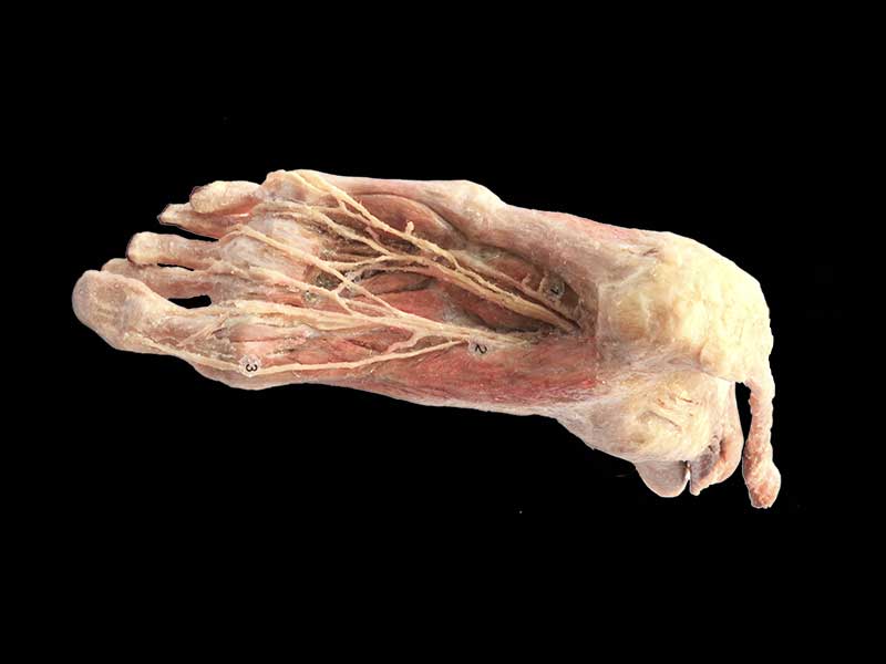 Plantar artery anatomy specimen