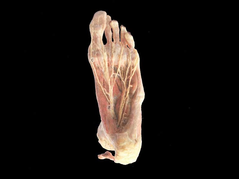 Plantar artery plastination specimen