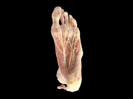 Plantar artery plastination specimen