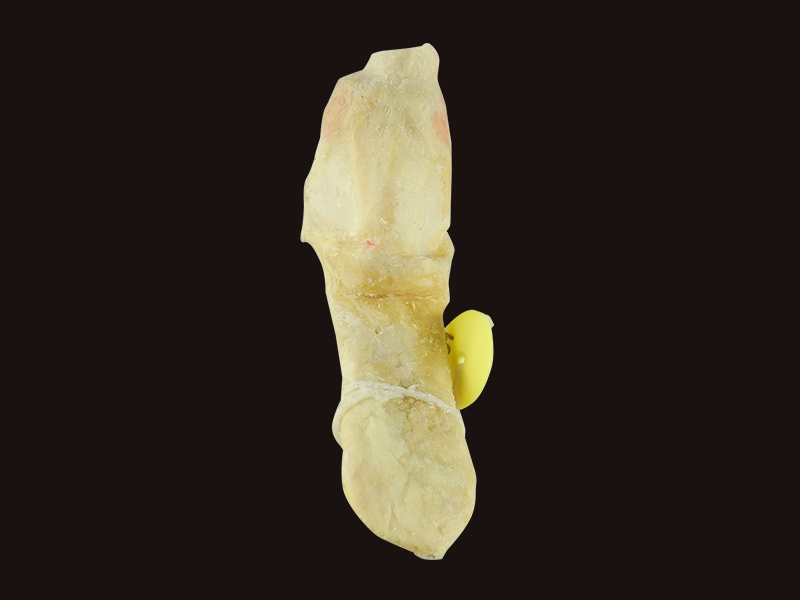 plastinated specimen
