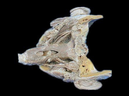 Posterior Pharyngeal muscle plastanated specimens (cost of plastinated specimens)