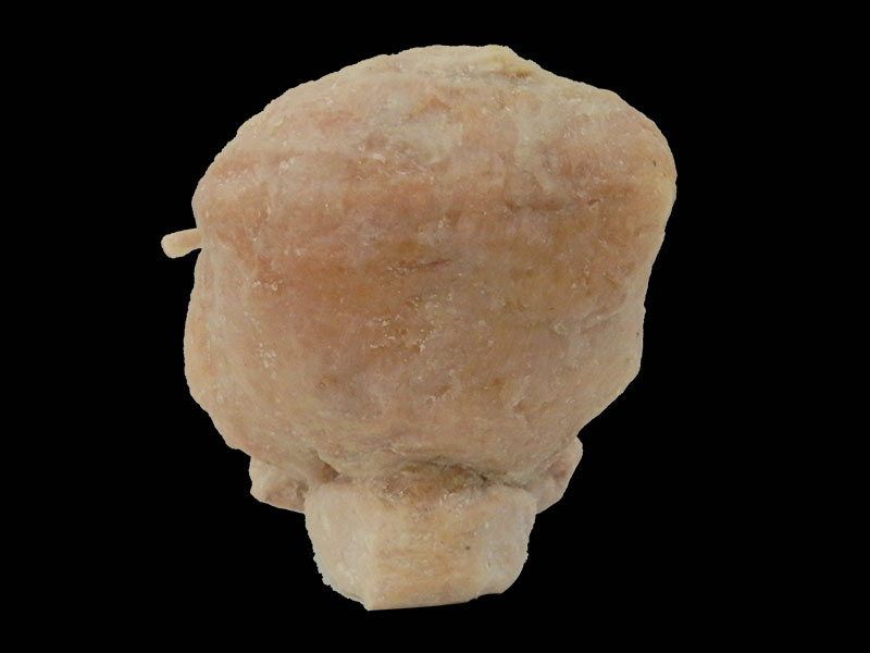 Prostate seminal vescle bladder plastinated specimen