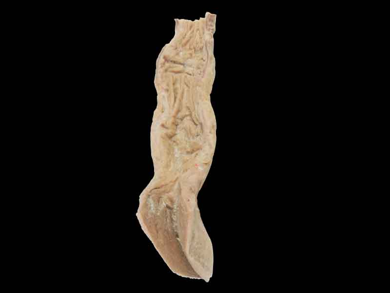 Rectum and anal canal