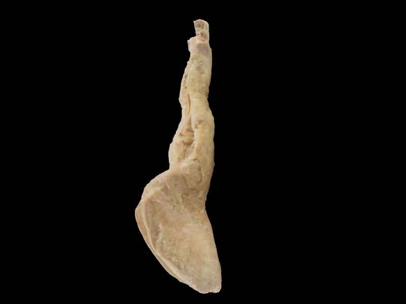 Rectum and anal canal plastinated specimen