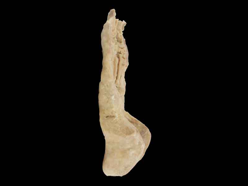 Rectum and anal canal plastination