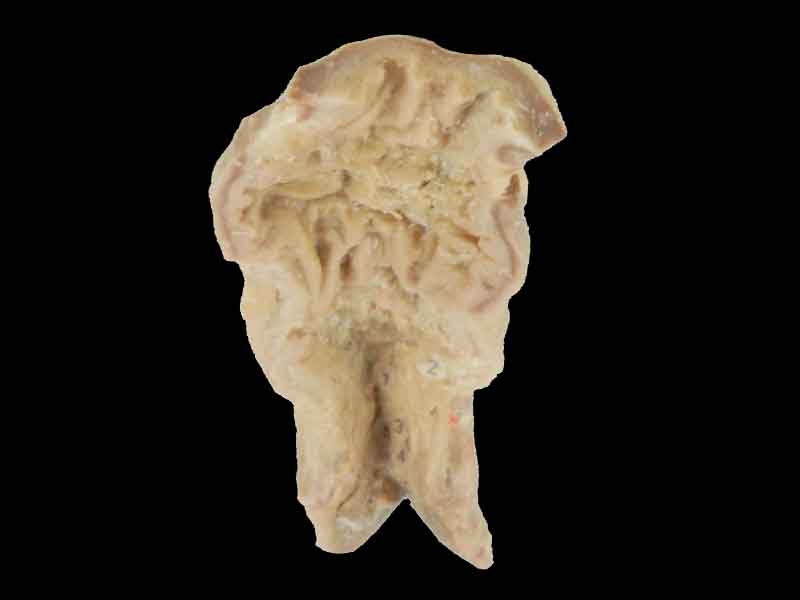 Rectum and anal canal teaching specimen