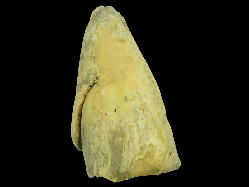 L-Lung