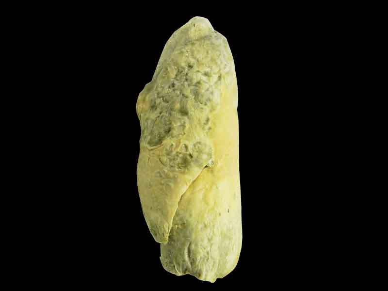 L-Lung plastinated specimen