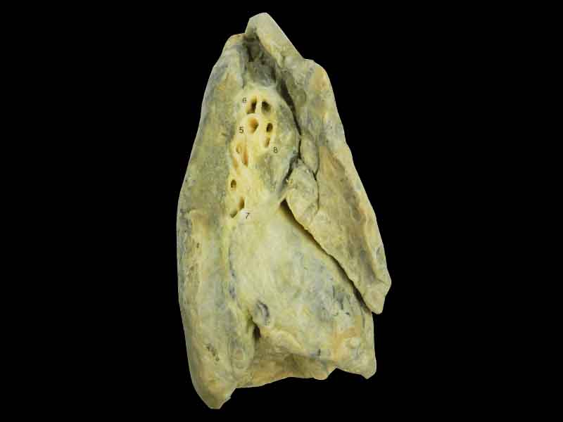 L-Lung plastination