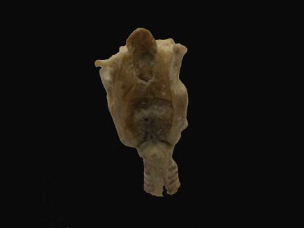 Laryngeal cartilage plastinated specimens( plastination gunther von hagens )