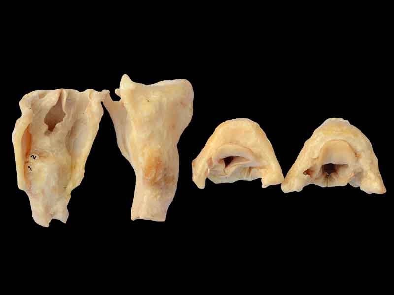 Laryngeal cartilages plastinated specimen