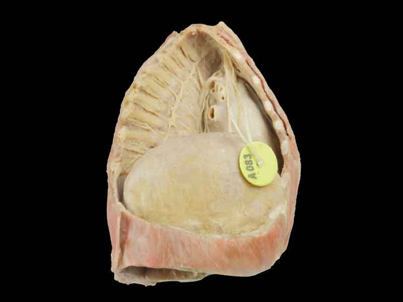 Mediastinum
