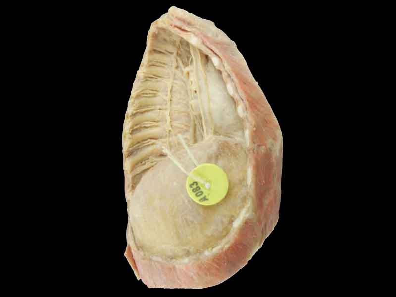 Mediastinum plastinated specimen
