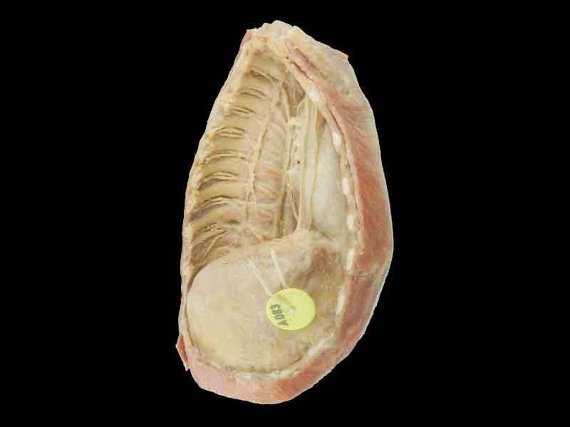 Mediastinum teaching specimen