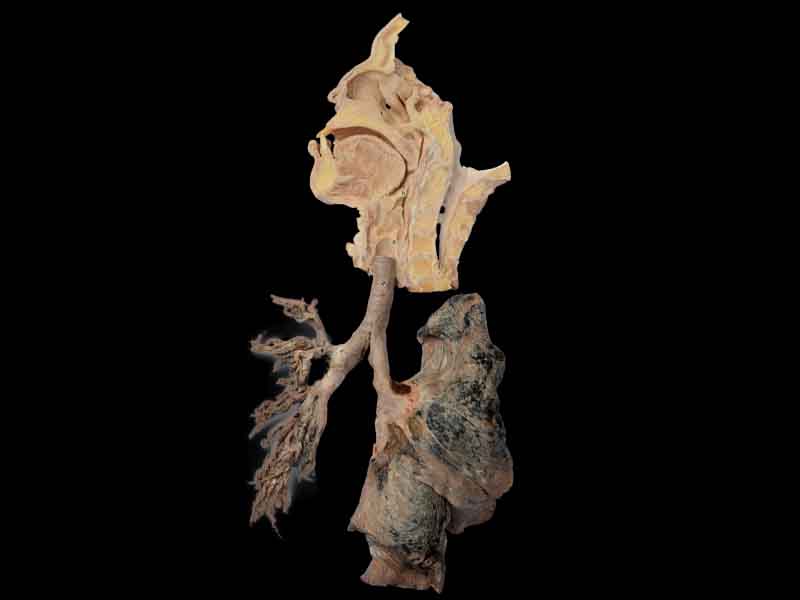 overview of respiratory system in vitro
