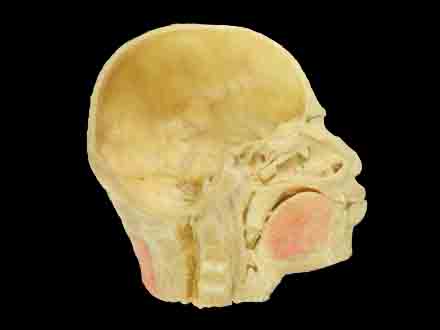 Paranasal sinuses and its opening